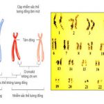 Nhiễm sắc thể và đột biến cấu trúc nhiễm sắc thể